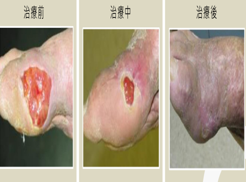 Divina Grace SOS急救再生霜 15ml【KX063】