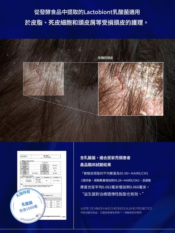 SMIB 全新 1000億乳酸菌防脫髮洗髮乳 400ml 【SE253】