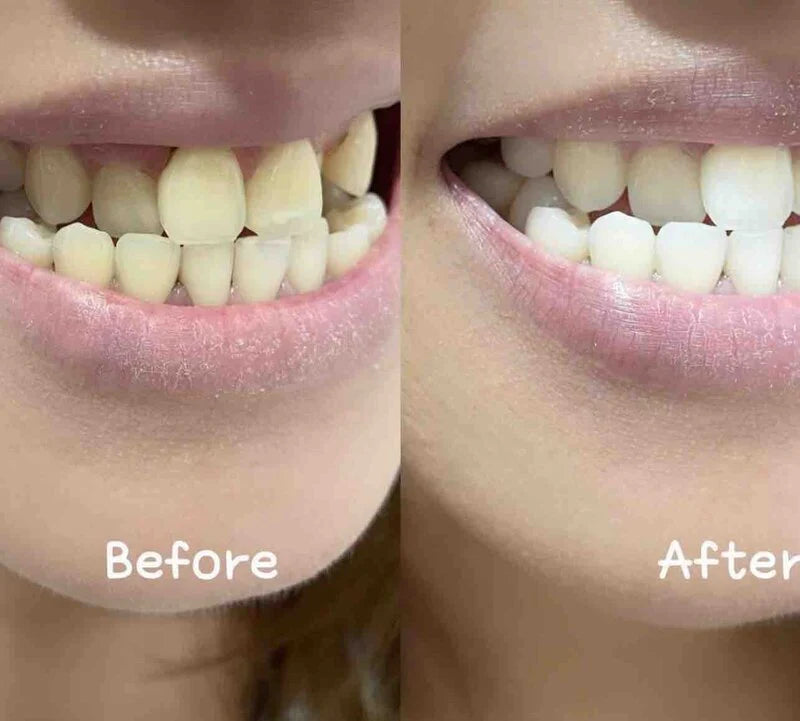 New Smile 全新益生菌光感美白牙膏【SM612】