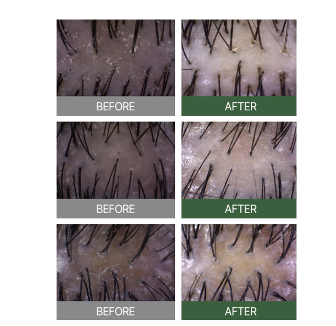 韓國 Fromforet 外泌體生髮精華滾珠棒 15ml【SE084】