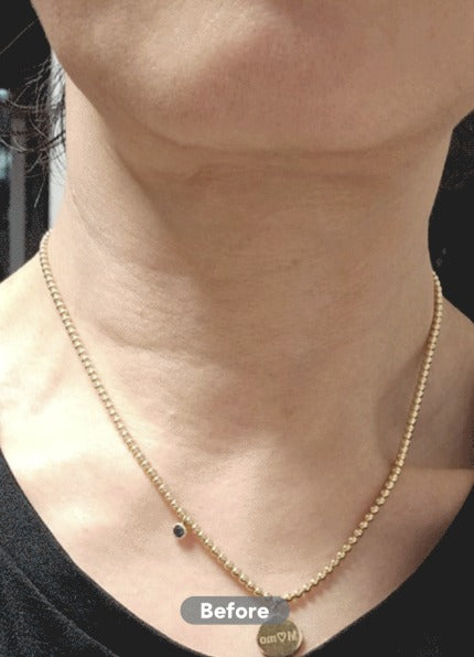 韓國SkinFox 第四代V-Neck微針提拉頸膜 一盒 7 片【KX168】