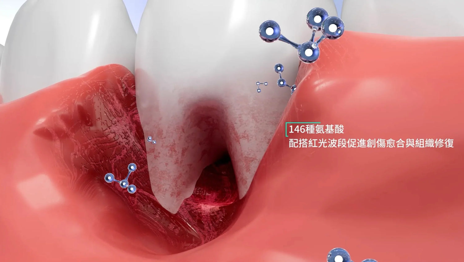 New Smile 第五代美白牙齒機 (內含New Smile 益生菌牙膏)【SM609】