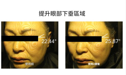 ABER外泌體緊緻眼霜 25g【SE004】