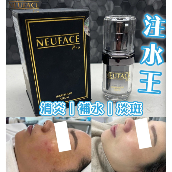 韓國製 Neuface Pro 注水王爆水精華 30ml