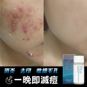 韓國製 PIOS SUPREME INSTANT SPOTS REMOVER 瞬時去痘淨膚精華 (一套兩支)