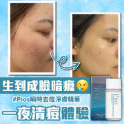 韓國製 PIOS SUPREME INSTANT SPOTS REMOVER 瞬時去痘淨膚精華 (一套兩支)